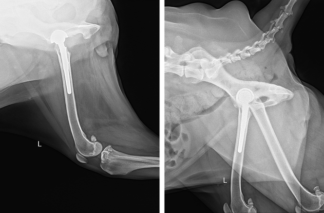 THR 수술후 X-ray 사진2